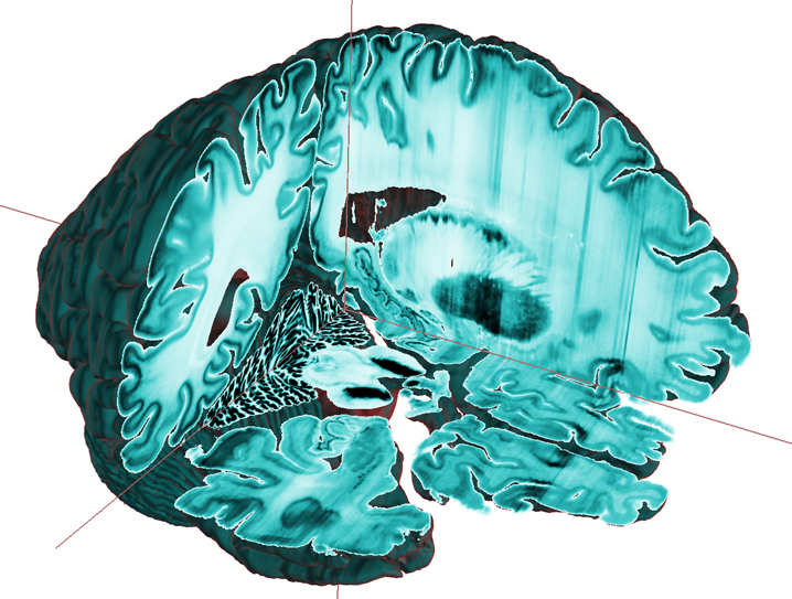 Sobre Google Maps para o cérebro criado por um Português